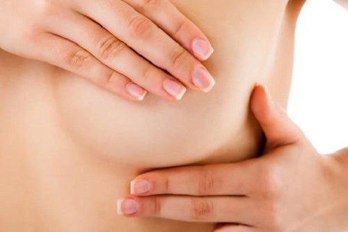 Ngực bị thay đổi hình dạng, kích thước, núm vú sần sùi, tiết dịch, xuất hiện khối u cục... có thể là dấu hiệu của ung thư vú.